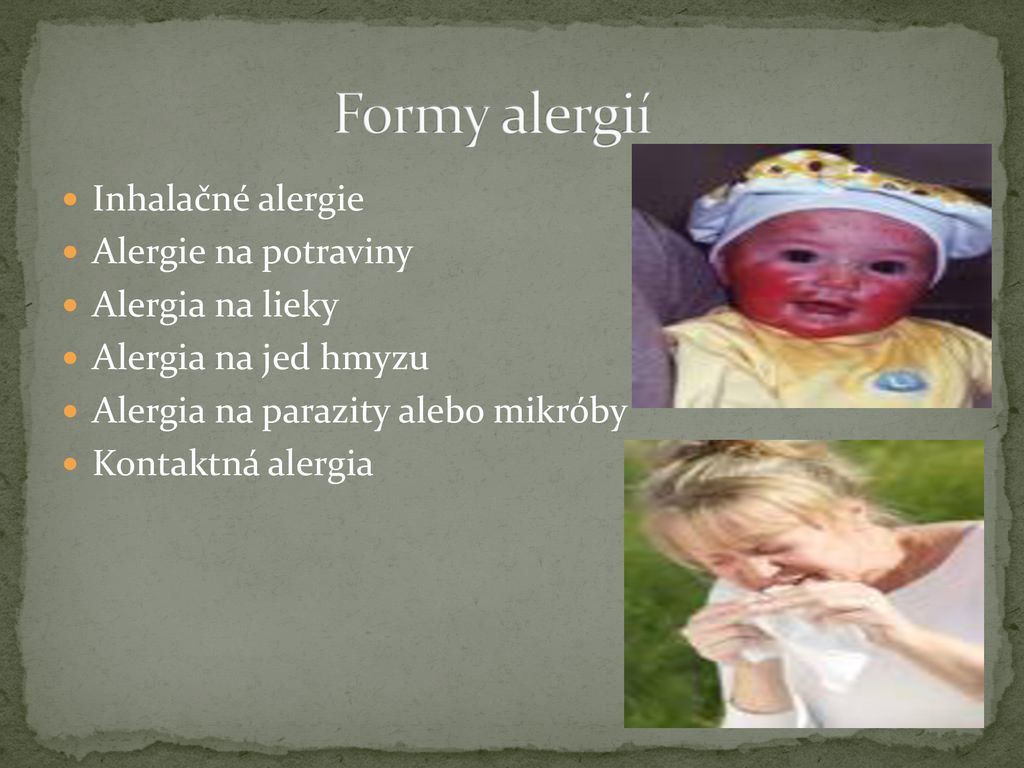 Formy alergií Inhalačné alergie Alergie na potraviny Alergia na lieky