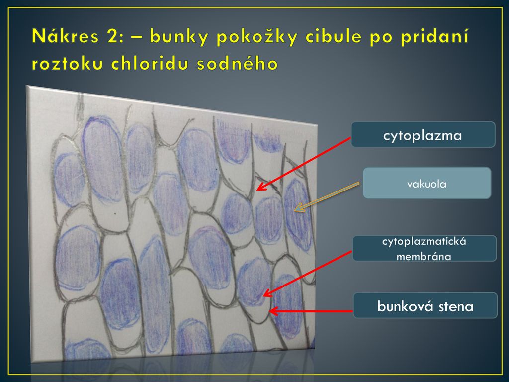 Nákres 2: – bunky pokožky cibule po pridaní roztoku chloridu sodného