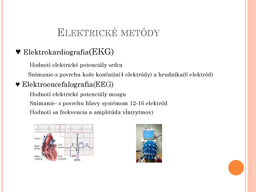 Elektrické metódy ♥ Elektrokardiografia(EKG)